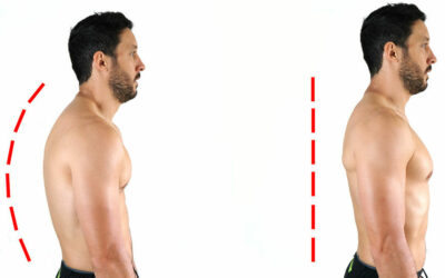 La mala postura ¿se puede corregir?