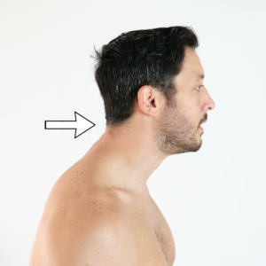 cabeza adelantada: ejercicios