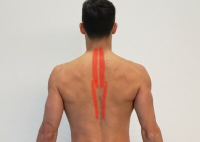 Esplenios y semi espinosos