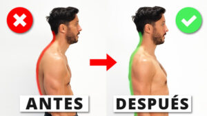 Corregir los hombros caídos Corregir los hombros caídos