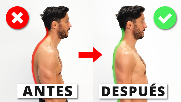 Corregir los hombros caídos Corregir los hombros caídos