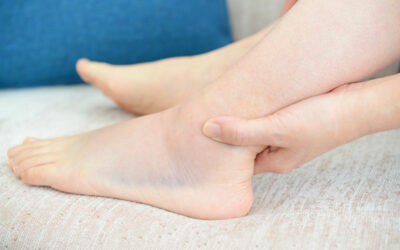 Tobillo hinchado: ¿Cuánto tiempo dura un esguince? 