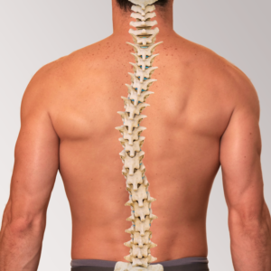 Escoliosis Escoliosis
