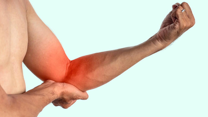 Cómo tratar una tendinitis Cómo tratar una tendinitis