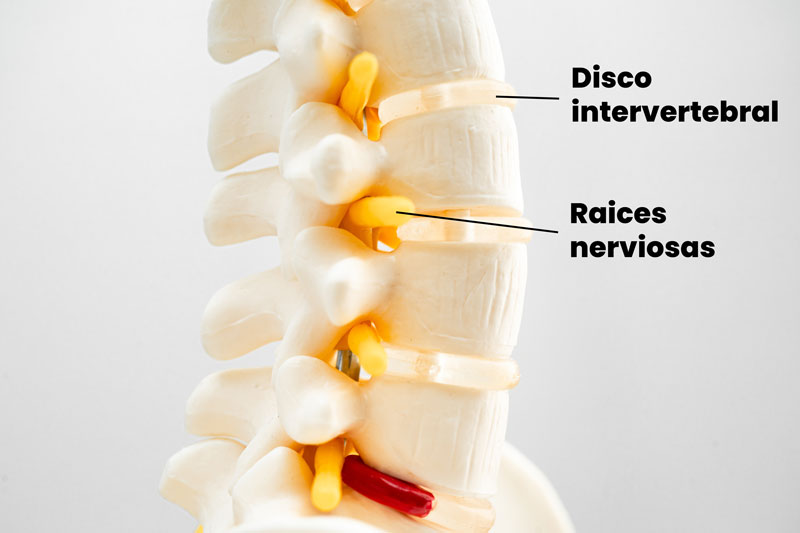 Columna lumbar y nervios Columna lumbar y nervios