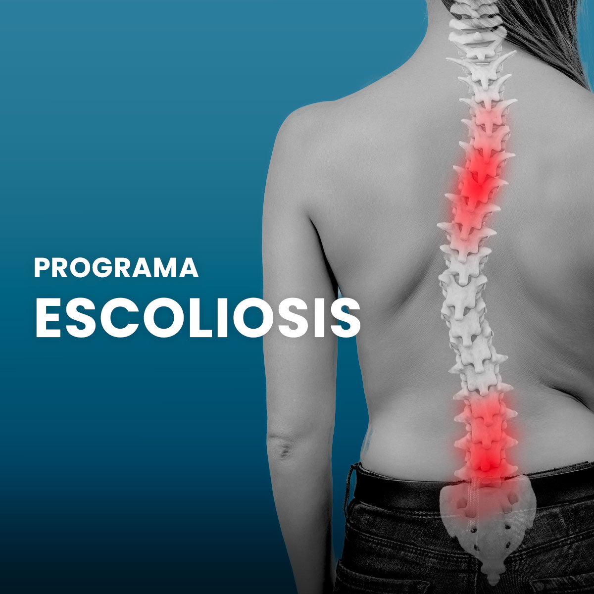 Nuevo Programa Escoliosis Nuevo Programa Escoliosis