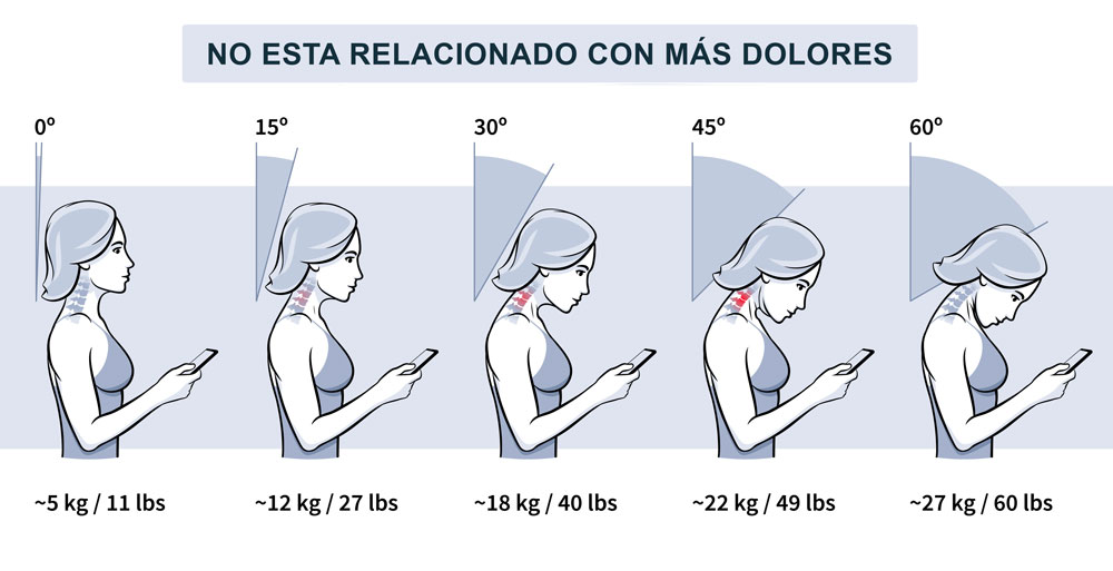 Sindrome del text neck Sindrome del text neck