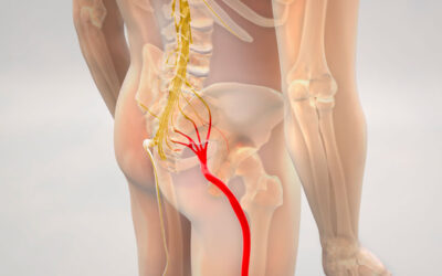 ¿Qué es el nervio ciático? Anatomía y trayecto
