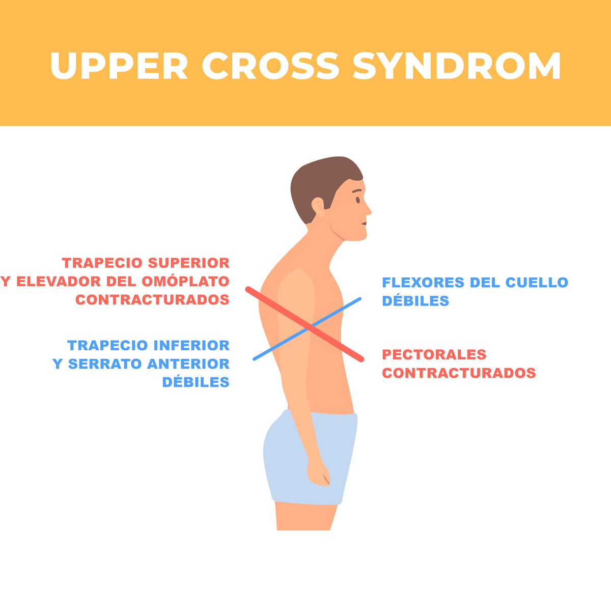 Upper cross syndrom